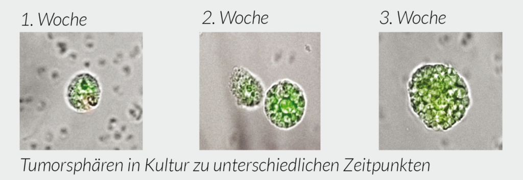 Tumorstammzell-Analyse-typisches Sphäroidwachstum